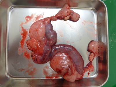 血尿症例の子宮 (2)-thumb-400x300-303.jpg